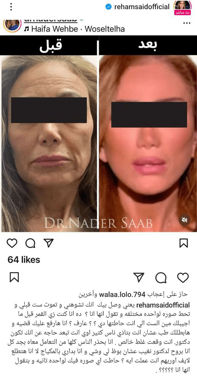 إعلامية مصرية تتهم طبيب تجميل مشهور بتشويهها 2 image 169