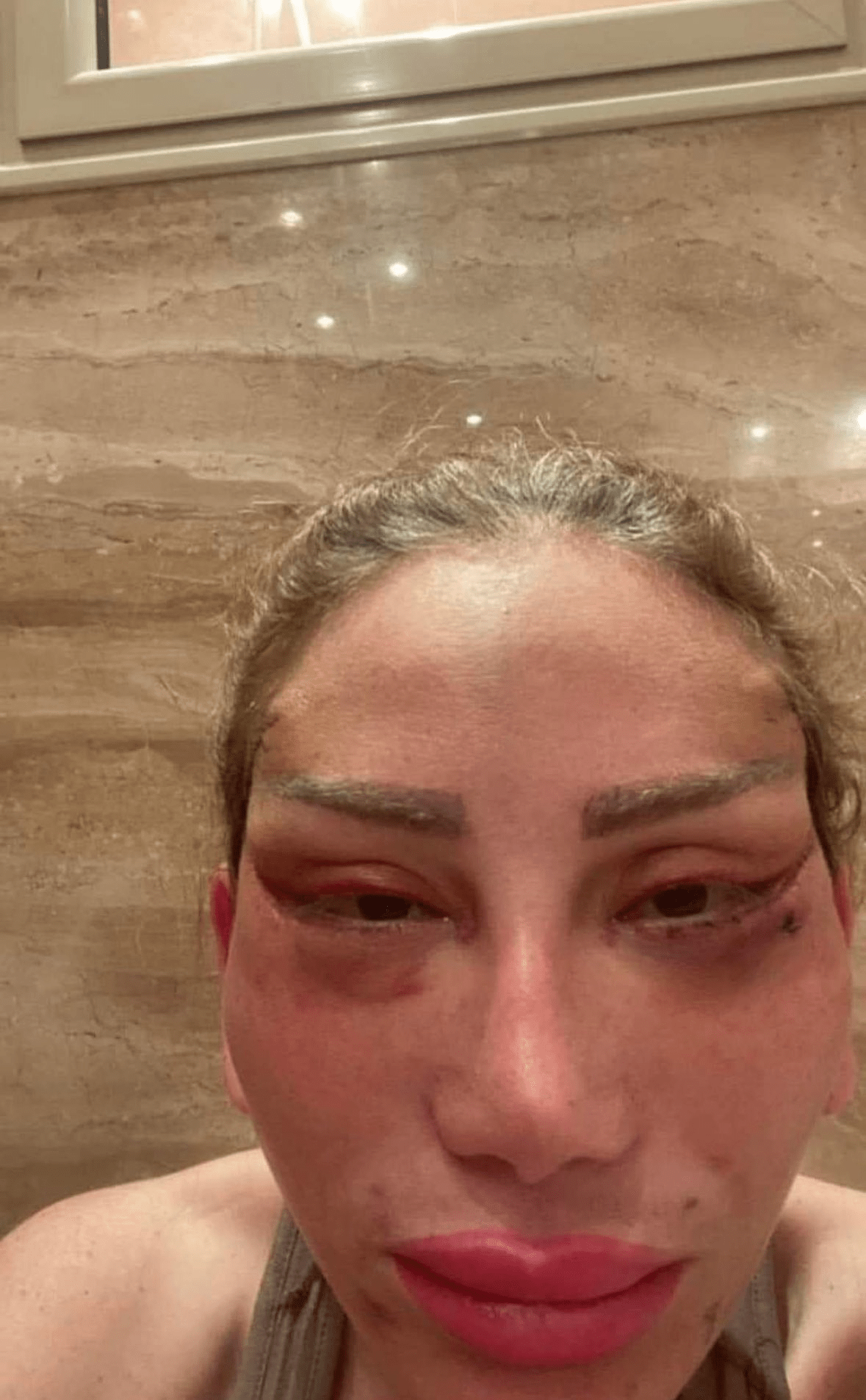 أحدث صورة كارثية للإعلامية ريهام سعيد: لن تتعرف عليها 3 image 172